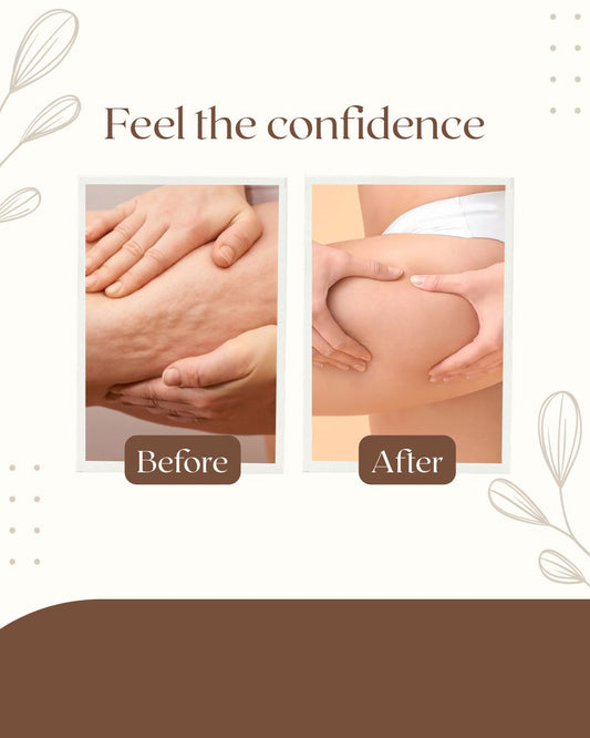 Glattere, straffere Haut – Anti-Cellulite Massagegerät mit Wärme & Schröpfmassage