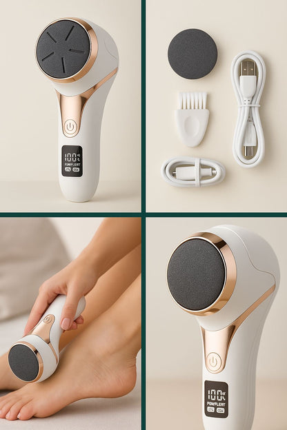 Hornhaut Entferner – Professionelle Fußpflege für Zuhause